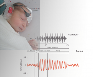 EEG-based procedures